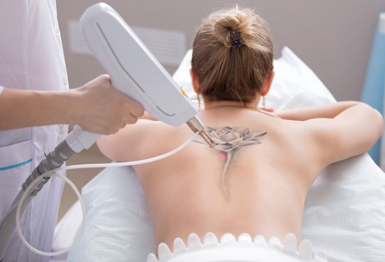 There’s nothing called as permanent! Now remove your permanent tattoos from your skin, through painless laser treatment.