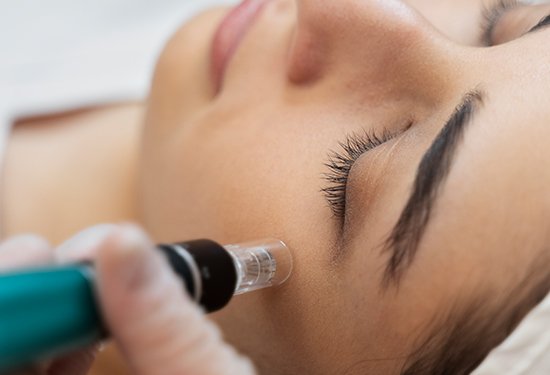 Why is the Hydrafacial great to do in the Winter?